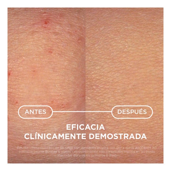 Bioderma Atoderm AD Intensive Baume Bálsamo Ultracalmante 75 ml