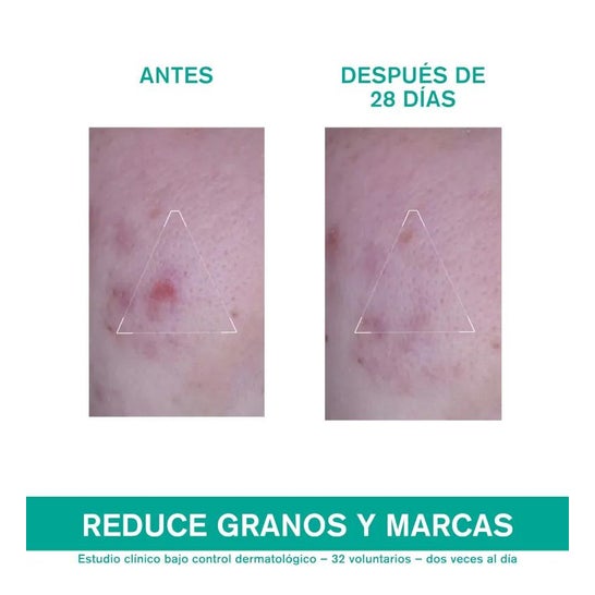Uriage Hyséac 3-Regul+ Cuidado Global Anti-imperfecciones 40ml