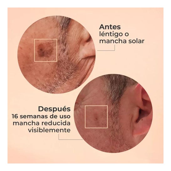 Segle Clinical Glicolmix Solución Exfoliante 20% AHA 30ml