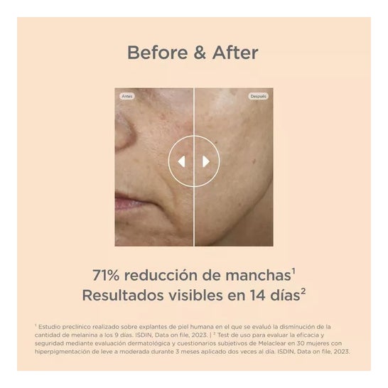 Isdin Isdinceutics Melaclear Refill 30ml