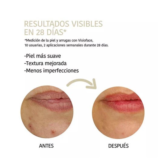 Iroha Nature Mascarilla Peeling Piel Perfecta Ácido Glicólico 20ml