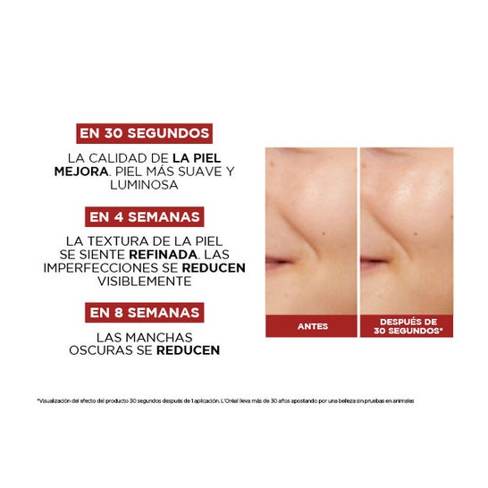 L'Oréal Revitalift Tónico Efecto Peeling Ácido Glicólico 180ml