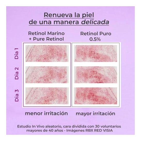 Segle Serúm Pure Retinol 30ml