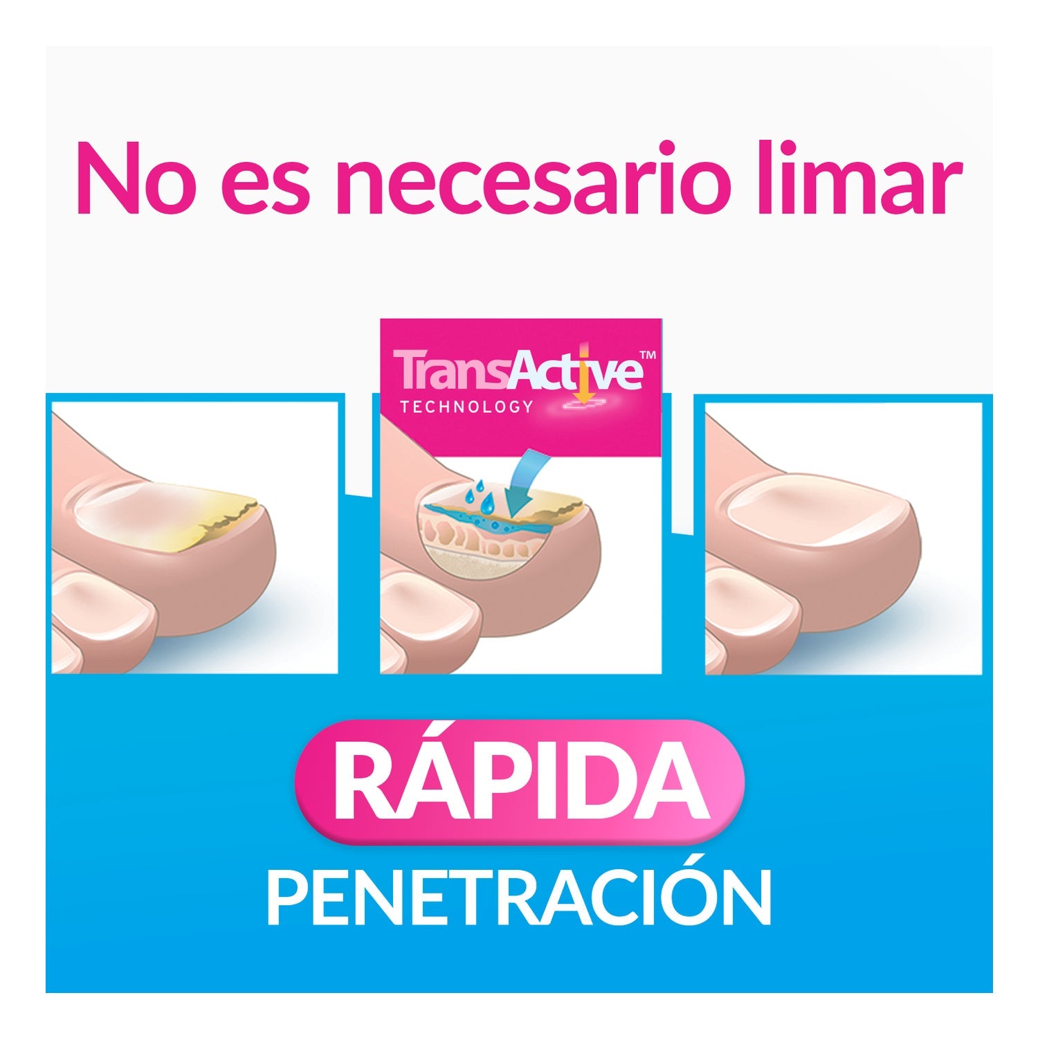 Excilor Esmalte Tratamiento de la Micosis de las Uñas 3,3ml