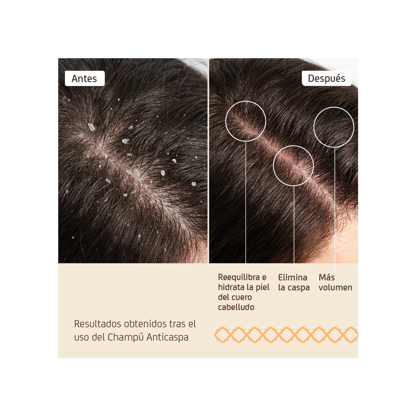 Nuggela & Sulé Champú Anti-caspa 250ml
