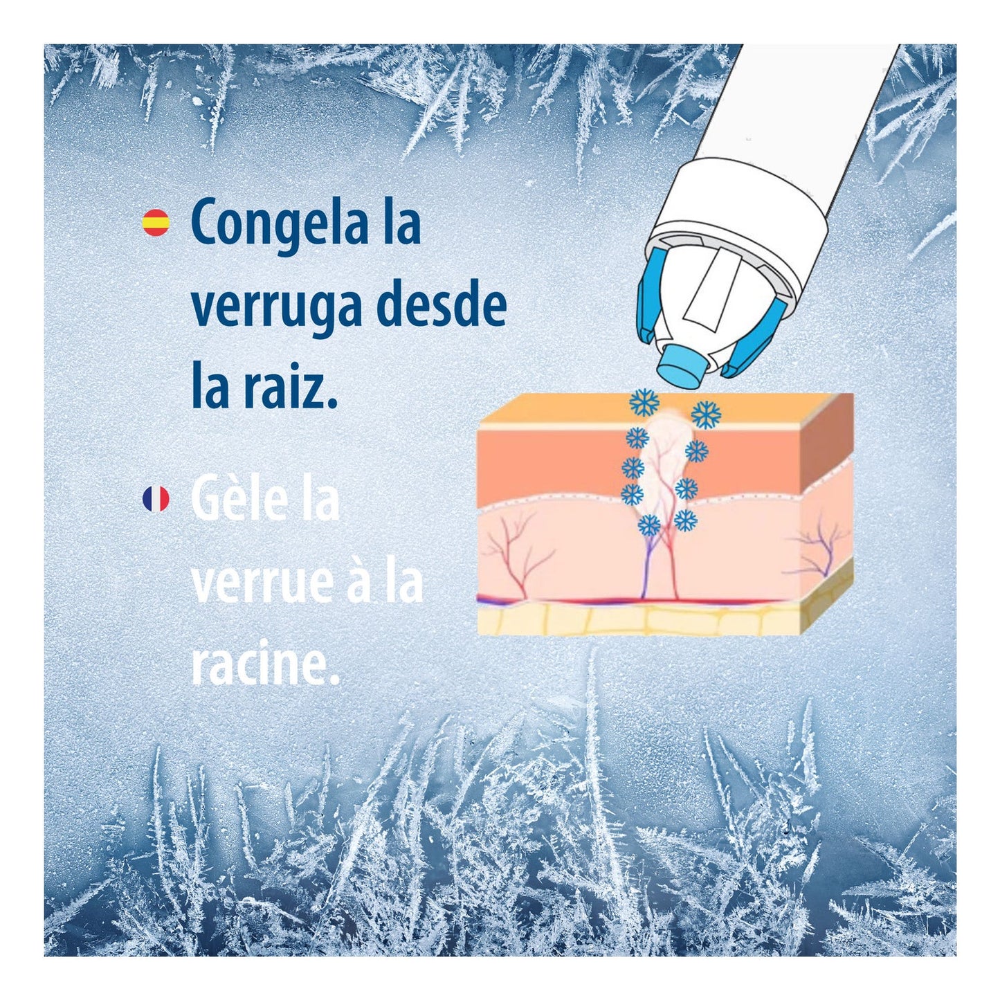 Evolsin Verrugas Crioterapia 75ml