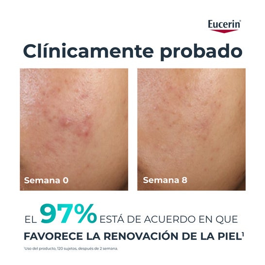 Eucerin DermoPure Clinical Peeling 10 40ml