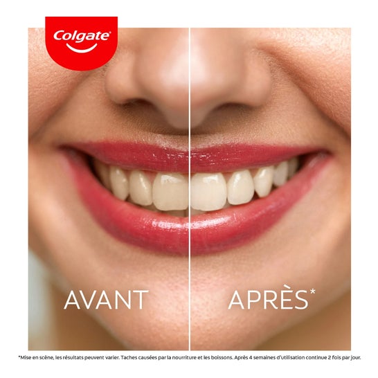 Colgate Max White Ultra 75ml