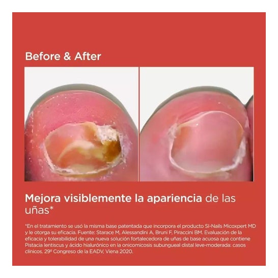 Isdin Si-Nails Micoxpert 4.5ml