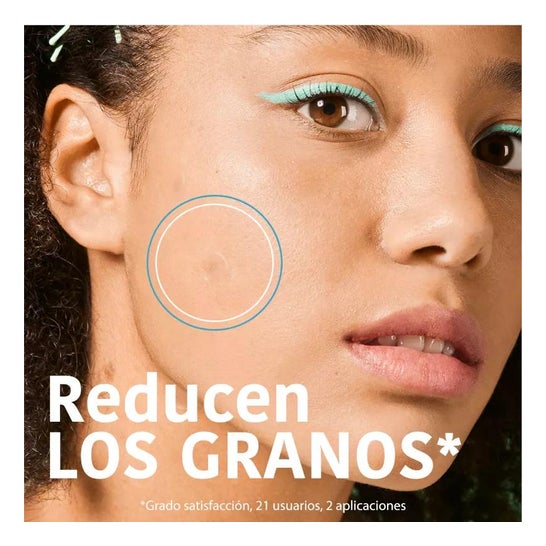Iroha Nature Parches SOS Granos para Acné Cara y Cuerpo 18uds