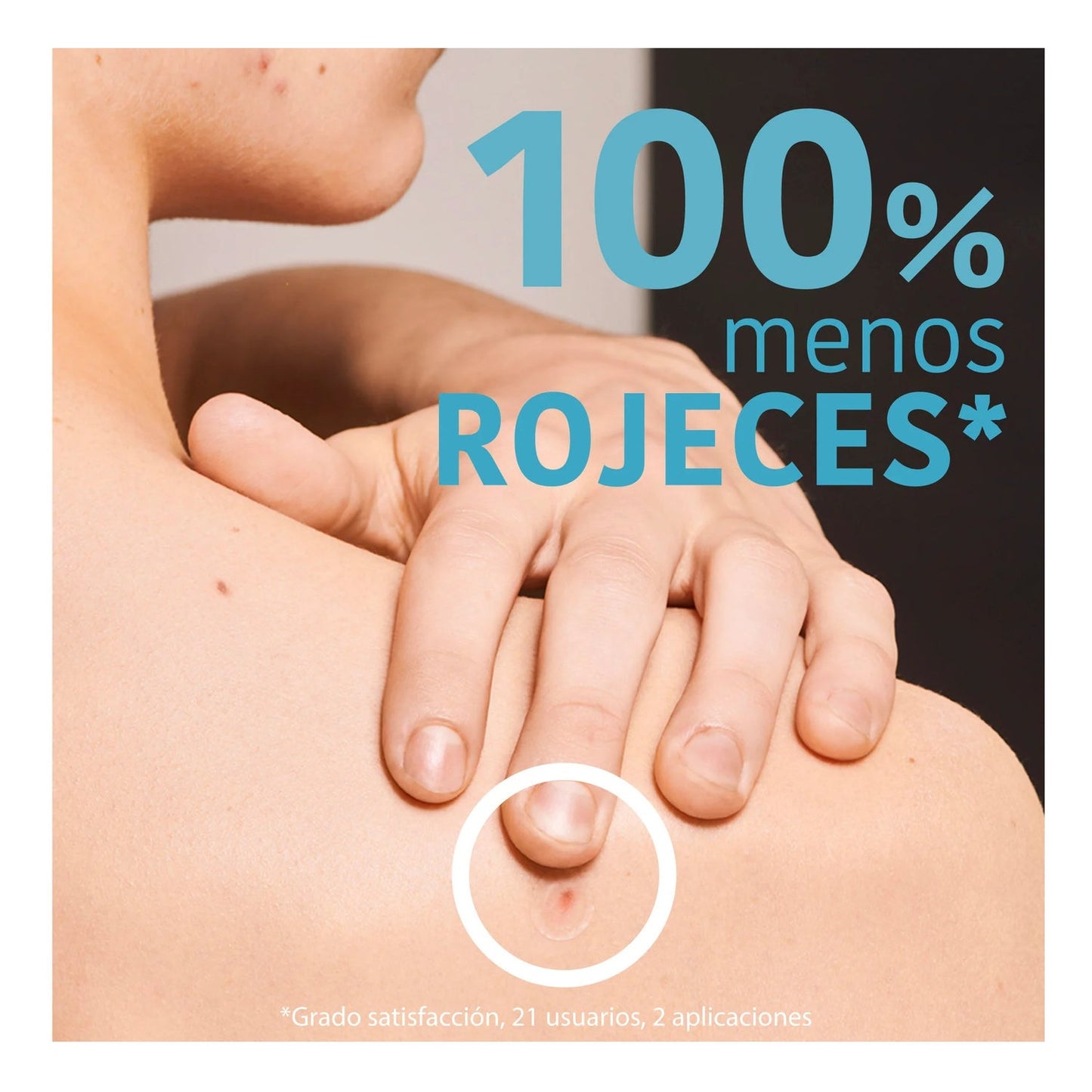 Iroha Nature Parches SOS Granos para Acné Cara y Cuerpo 18uds