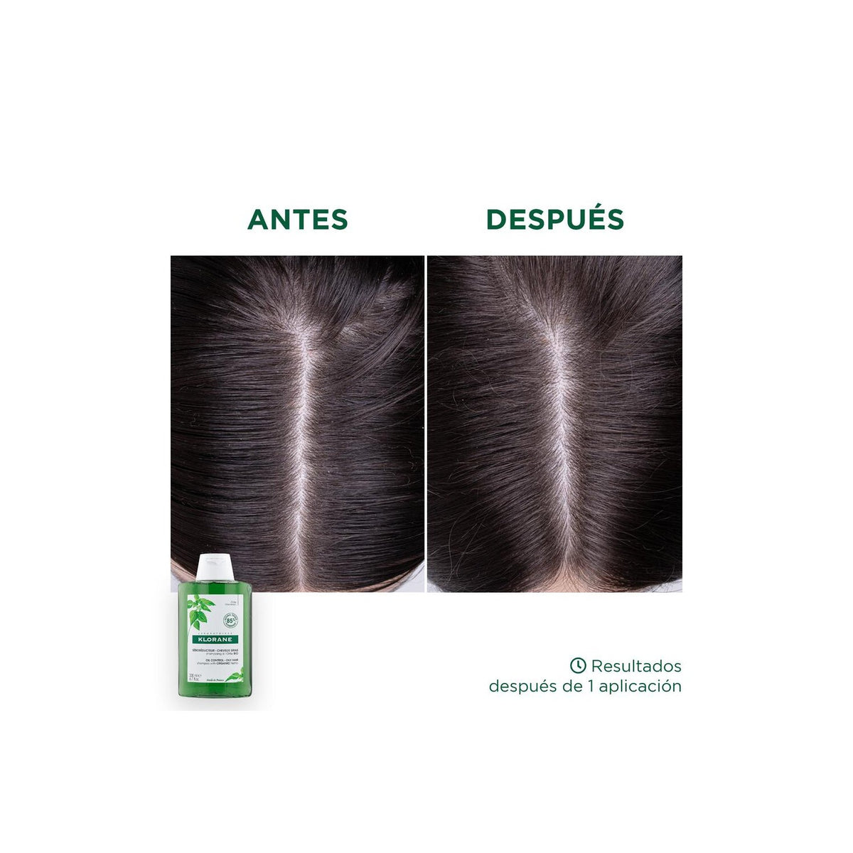 Klorane Champú a la Ortiga BIO 200 ml