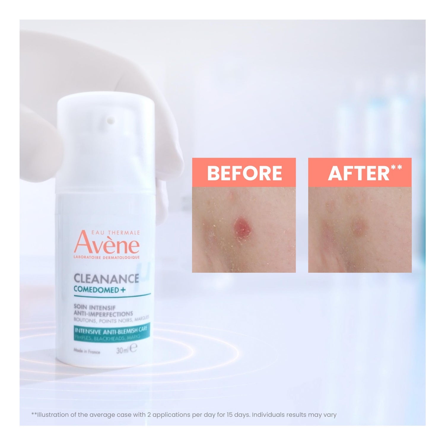 Avene Cleanance Comedomed+ Concentrado Anti-Imperfecciones 30ml