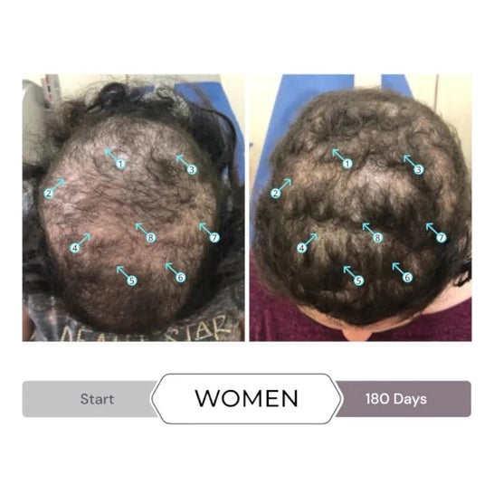 Spectral CSF Sistema de Revitalizacion del Cabello Loción 60ml