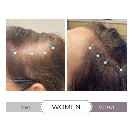 Spectral CSF Sistema de Revitalizacion del Cabello Loción 60ml