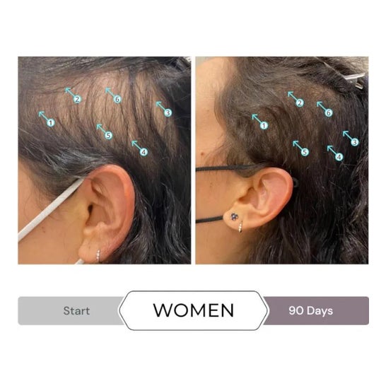 Spectral CSF Sistema de Revitalizacion del Cabello Loción 60ml
