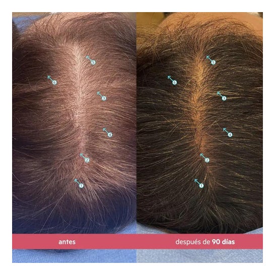 Spectral CSF Sistema de Revitalizacion del Cabello Loción 60ml