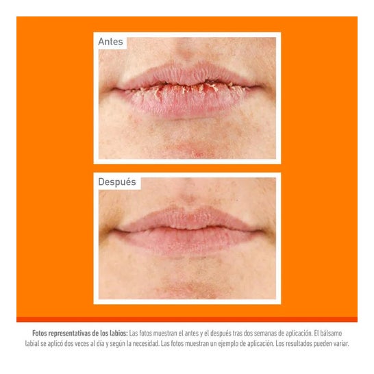 O'Keeffe'S Lip Repair Spf15 4.2g