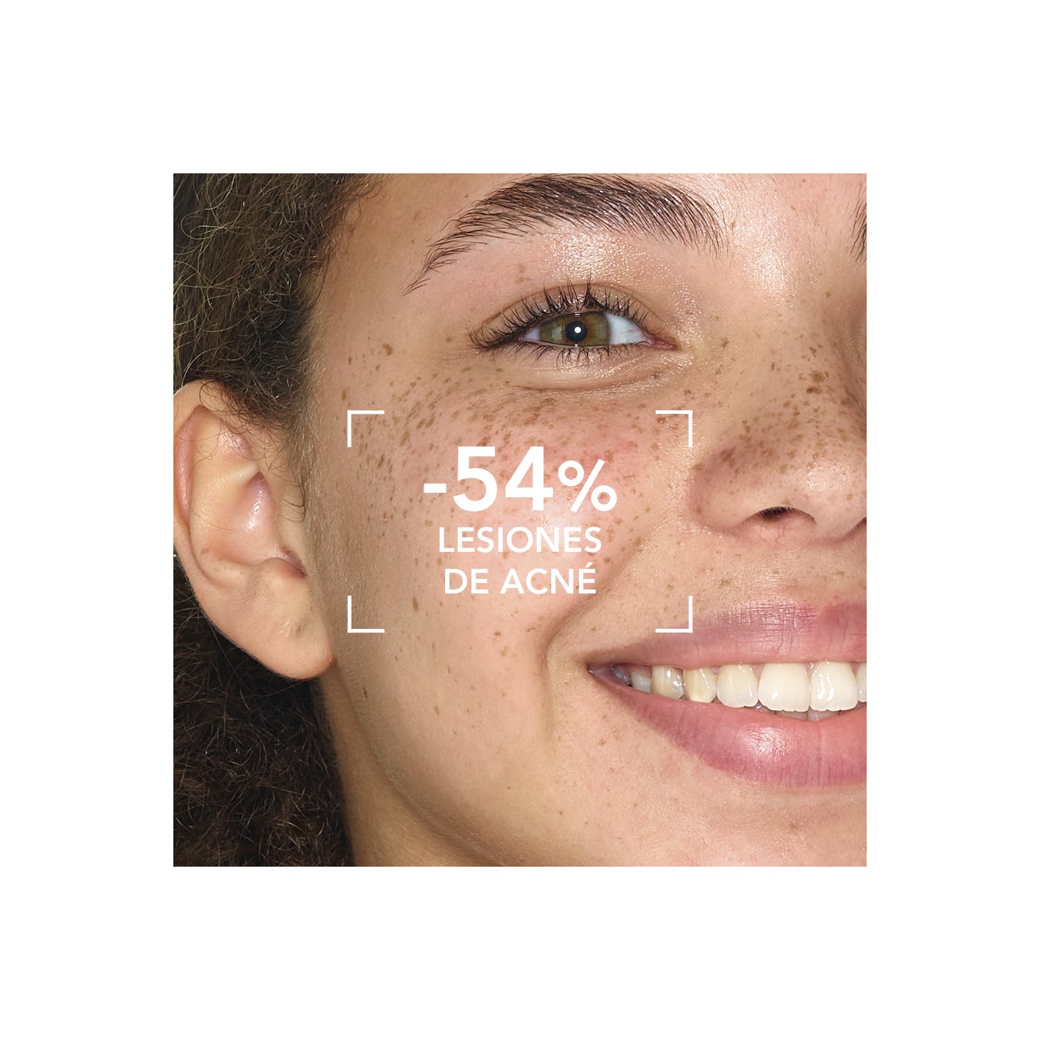 Bioderma Sébium Sensitive 30ml