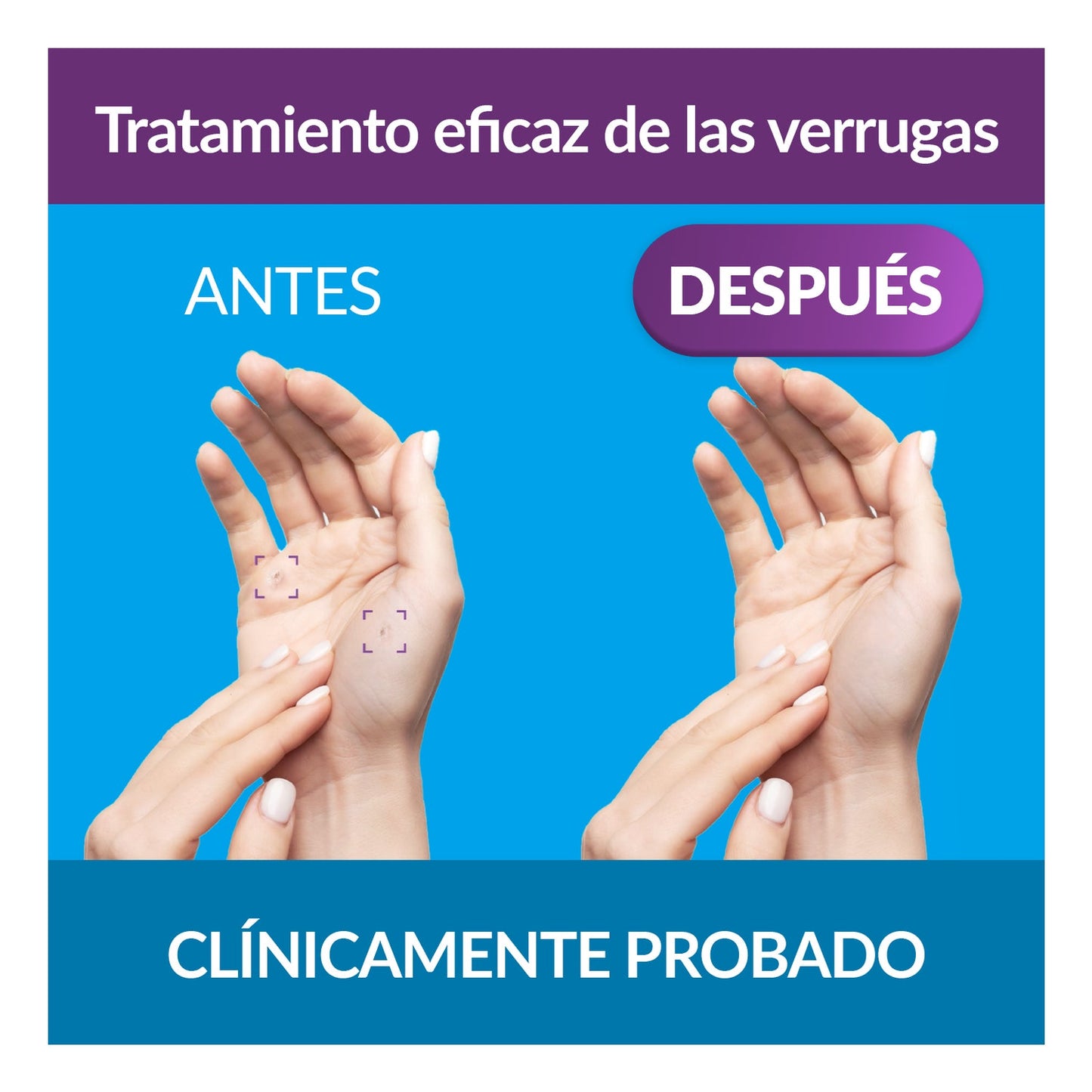 Excilor Gel Antiverrugas 4ml