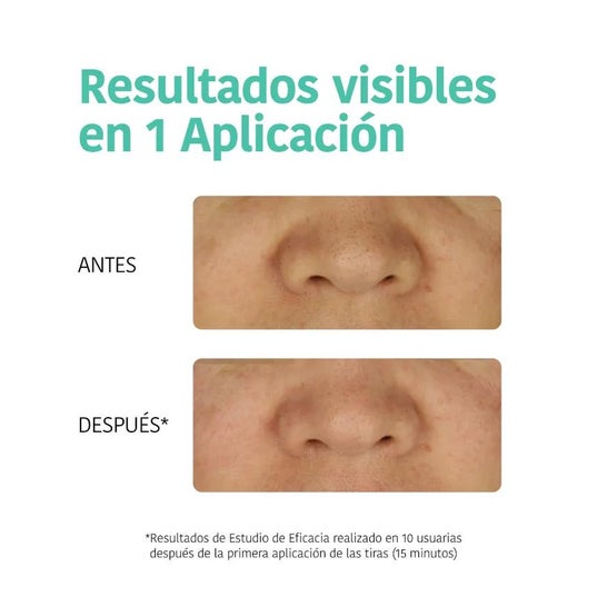 Iroha Nature Tiras Nariz Puntos Negros Detox Carbón 5uds