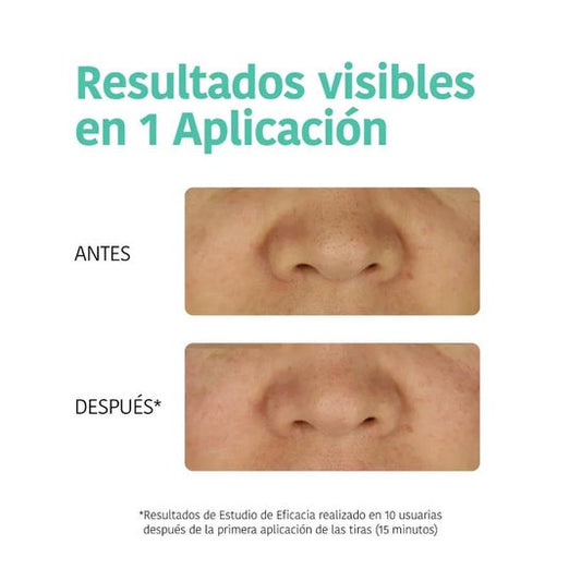 Iroha Nature Tiras Nariz Puntos Negros Detox Carbón 5uds