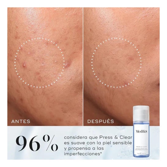 Medik8 Press & Clear 150ml
