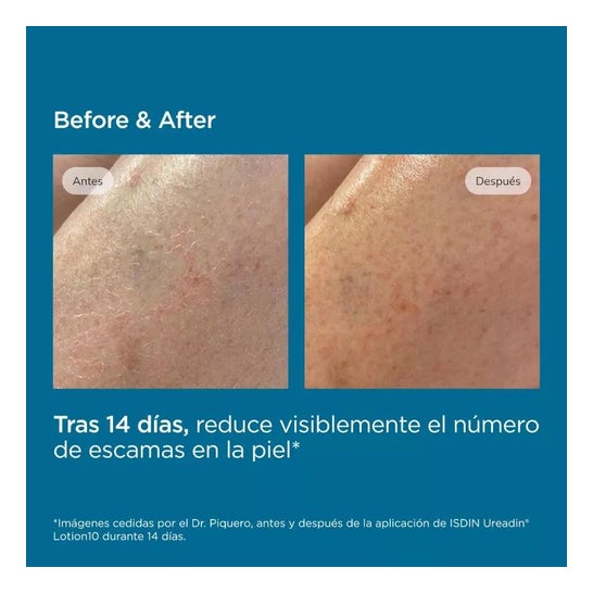 Ureadin Lotion10 Hidratación Intensa 750ml