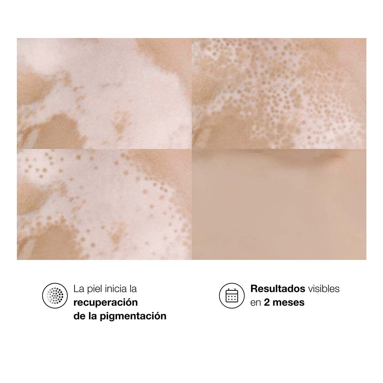 Bella Aurora Repigment12 Plus Crema Repigmentante Doble Acción 75ml