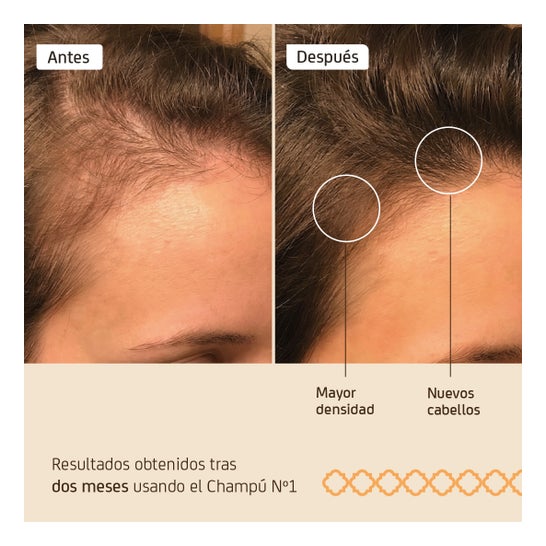Nuggela & Sulé Champú Premium nº1 Fuerza y Volumen Cebolla 250ml