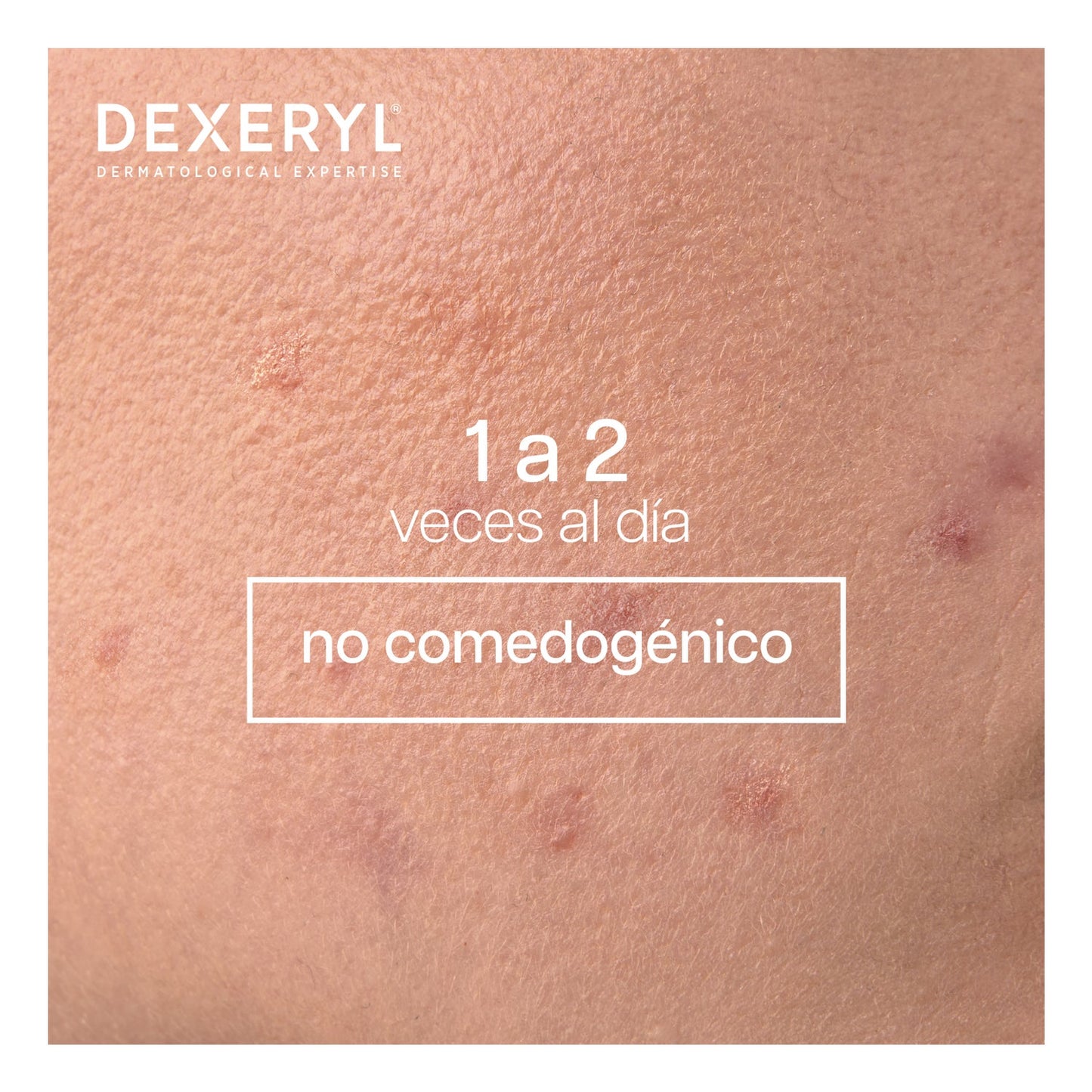 Dexeryl Dexeclear Limpiador Calmante Hidratante 400ml