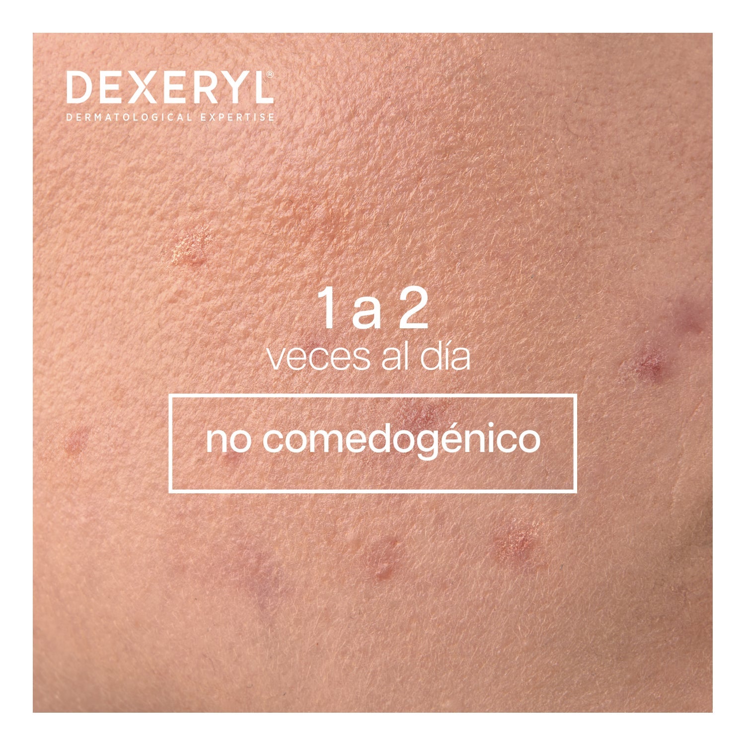 Dexeryl Dexeclear Limpiador Calmante Hidratante 400ml