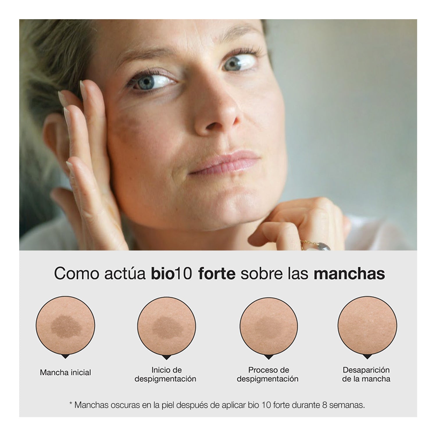 Bella Aurora Bio10 Forte L-Tigo Tratamiento Despigmentante 30ml