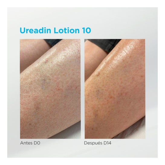 ISDIN Ureadin Lotion 10 Hidratación Intensa 1000ml