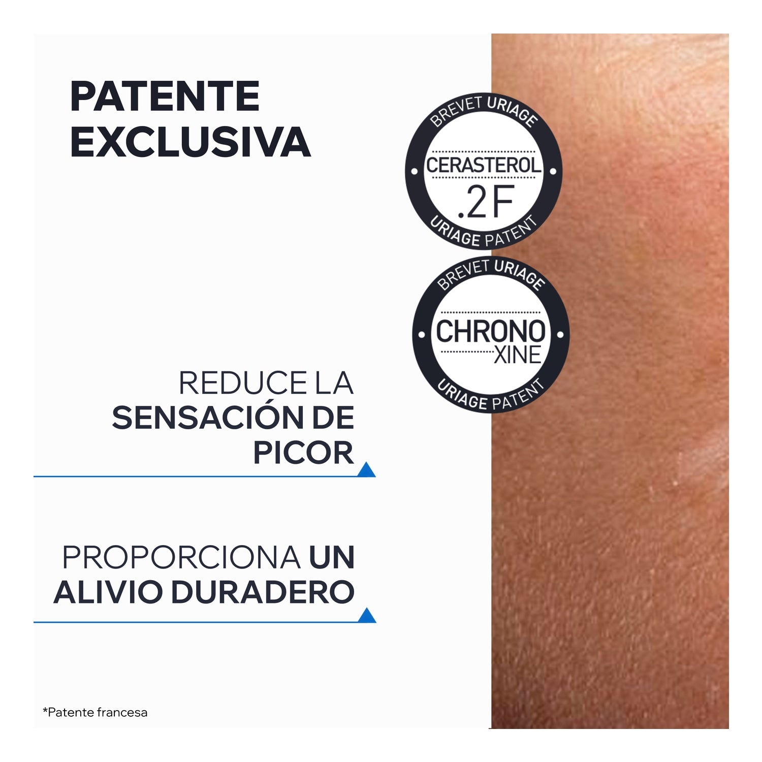 Uriage Xémose Bruma Sos Anti-Prurito 200ml