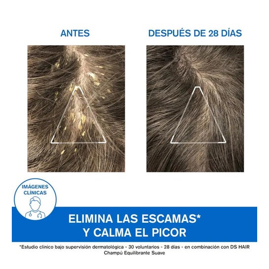 Uriage DS Hair Champú Queratorreductor 150ml