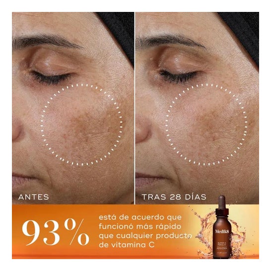 Medik8 Super C Ferulic 30ml