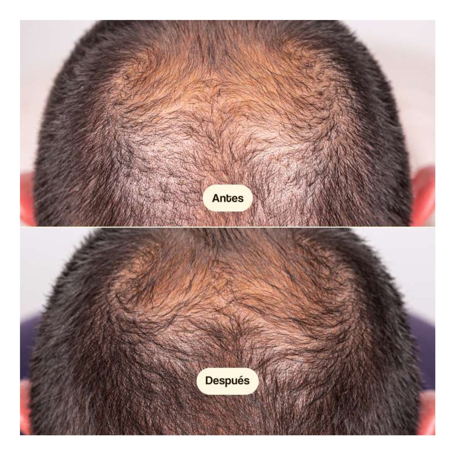 Freshly Cosmetics Hair Growth & Density Treatment 50ml