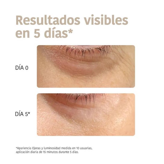 Iroha Nature Global Eye Care Parches Niacinamida Cafeína y Péptidos 2x8ml