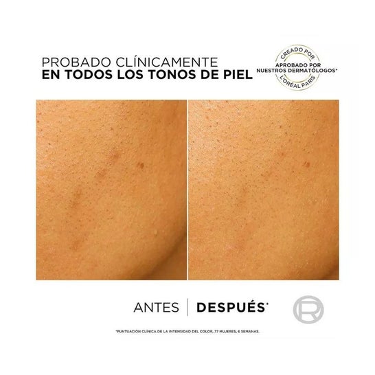 L'Oréal Bright Reveal Niacinamide Exfoliant Anti-taches 25ml