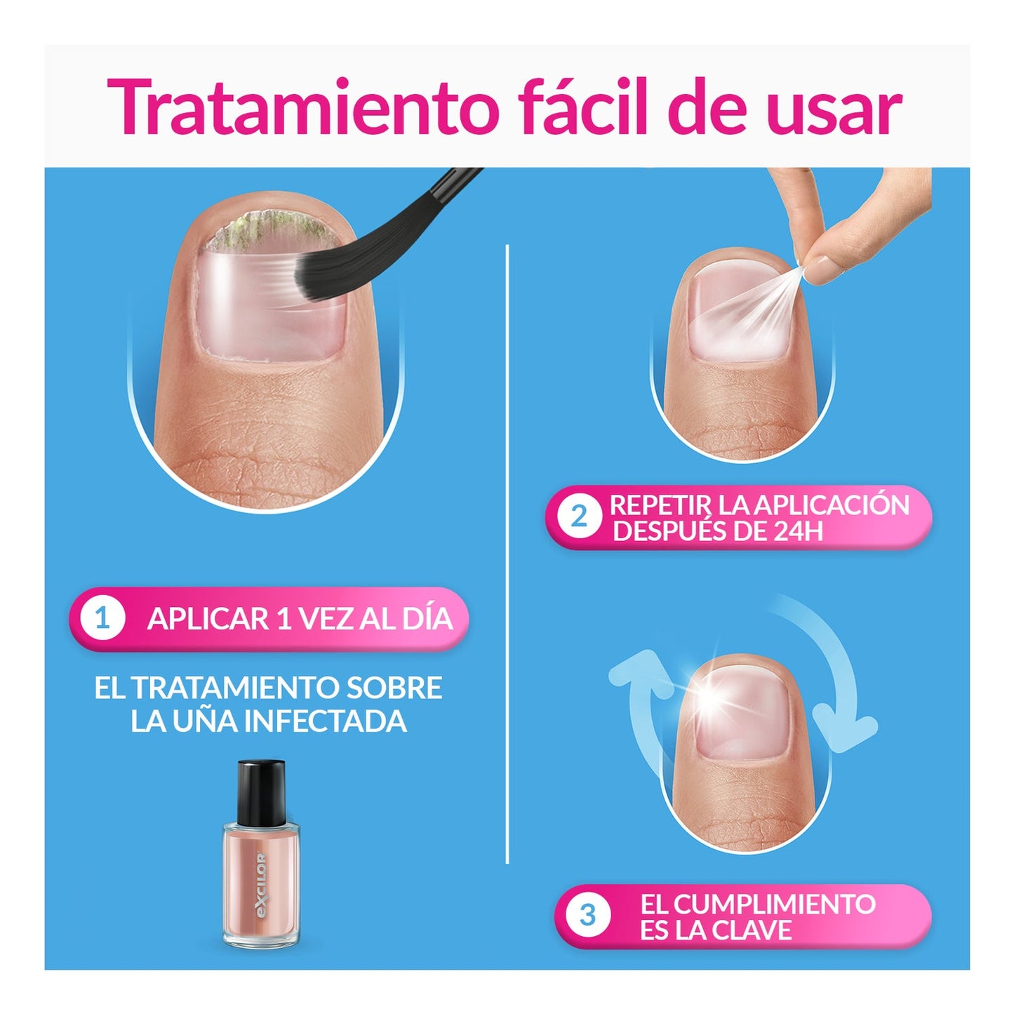 Excilor Forte Color Tratamiento de Hongos de Uñas Nude 30ml