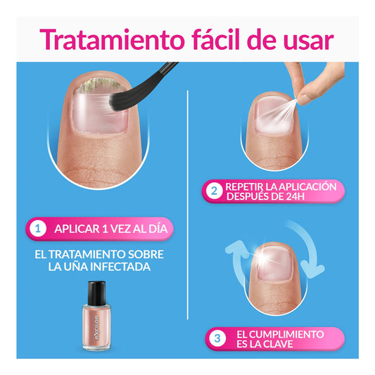 Excilor Forte Color Tratamiento de Hongos de Uñas Nude 30ml