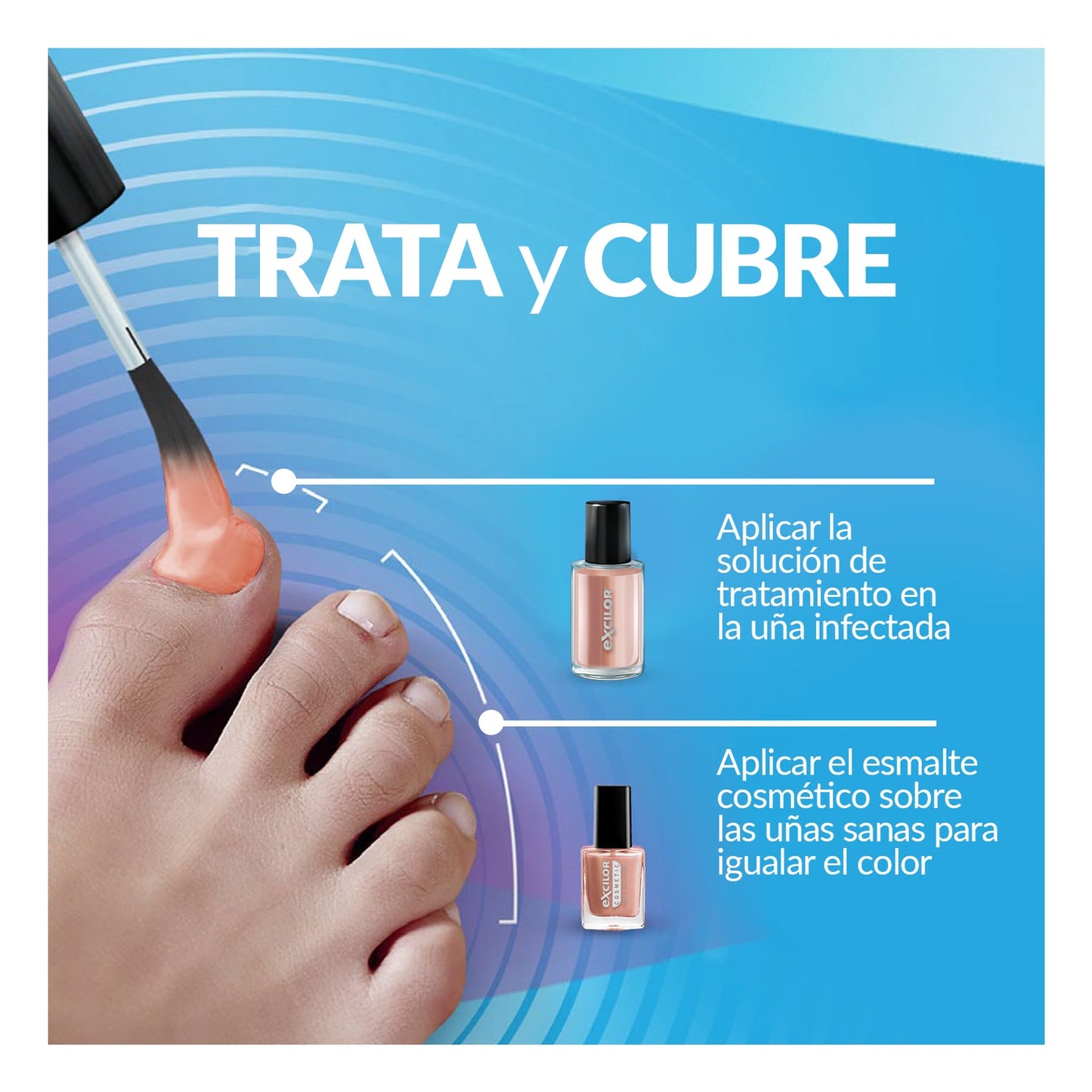 Excilor Forte Color Tratamiento de Hongos de Uñas Nude 30ml
