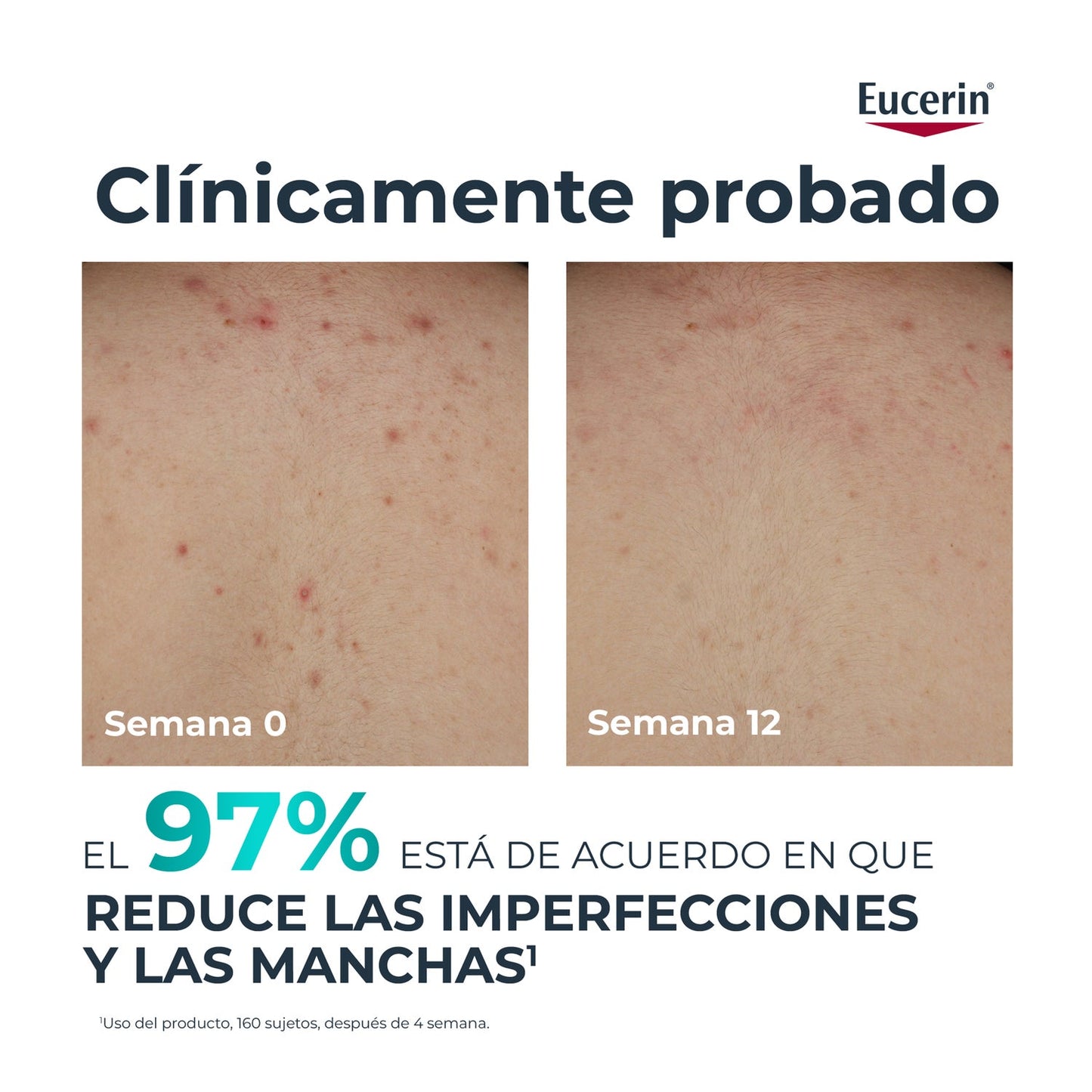 Eucerin DermoPure Clinical Crema Corporal Correctora 200ml