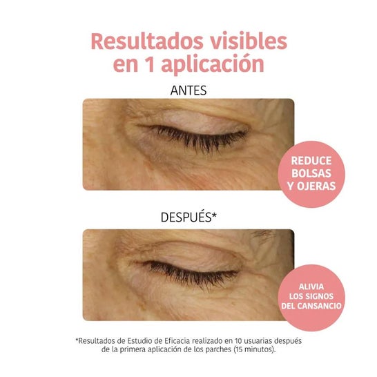 Iroha Nature Parches Anti-fatiga Iluminadores Vitamina C 2uds