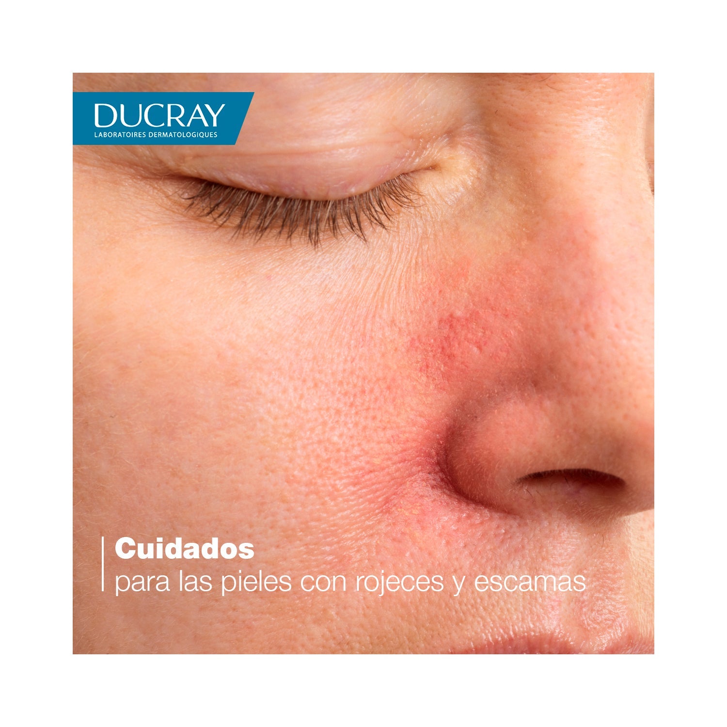 Ducray Kelual DS Crema Calmante 40ml